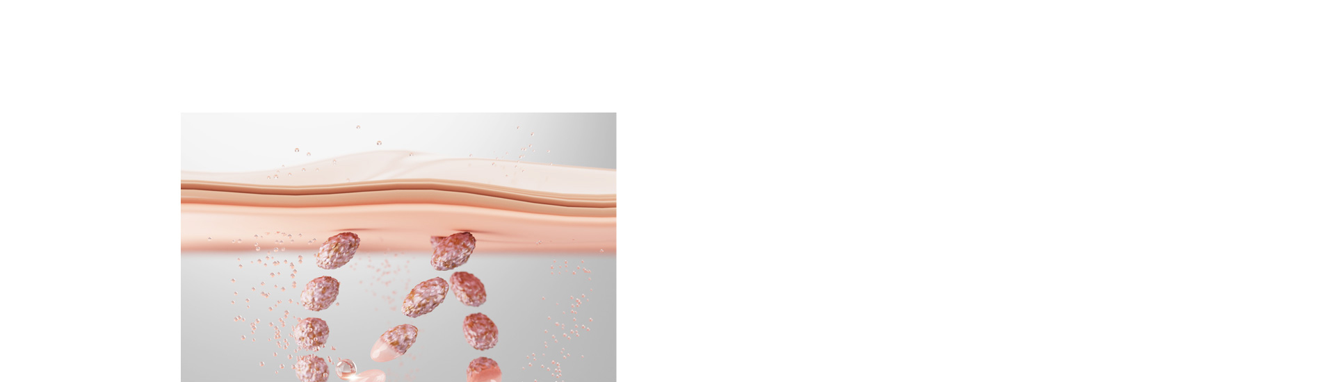 상안검수술 처진 눈매를 또렷하게!