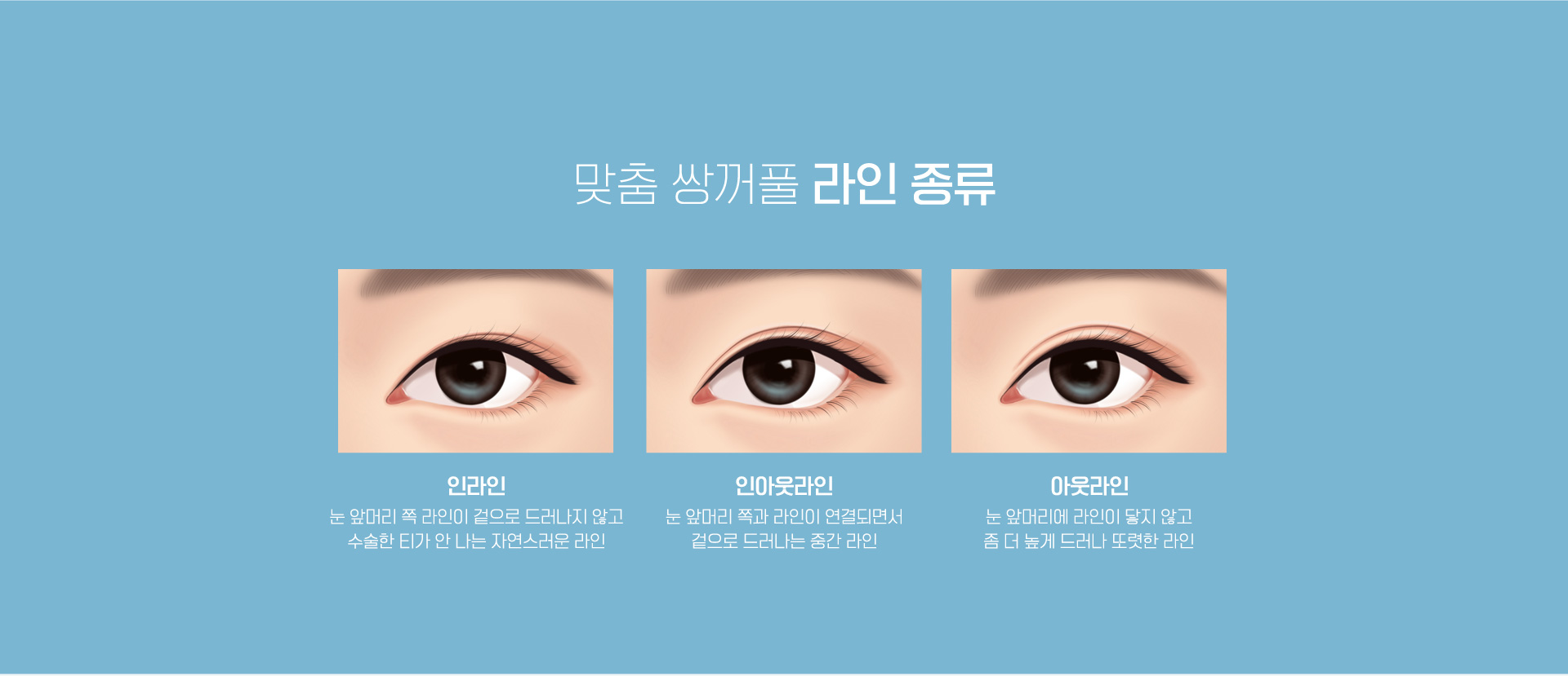 맞춤 쌍꺼풀 라인 종류